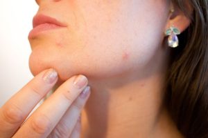 dermatološka ambulanta